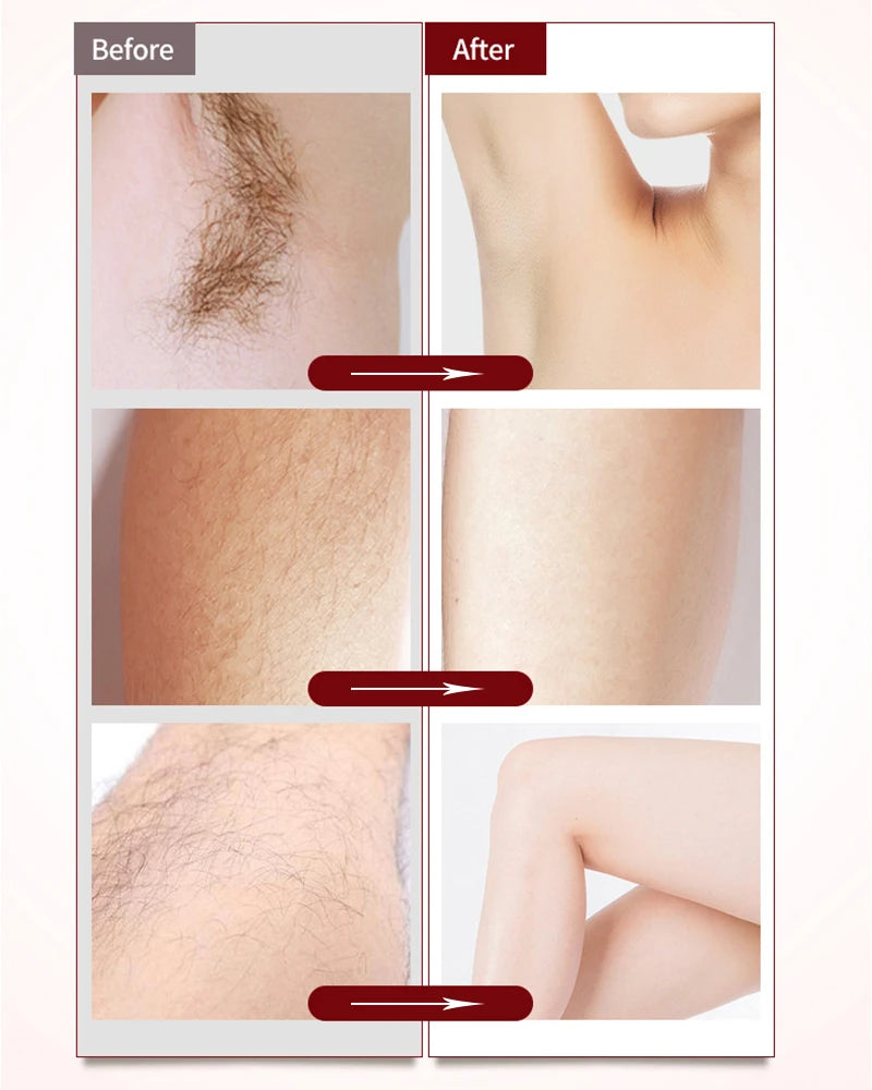 2 IN 1 Rechargeable Epilator Electric